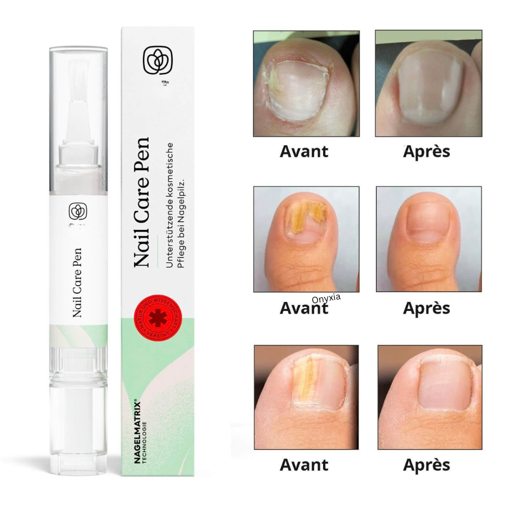 Onyxia™ — Pieds nus sans complexes.