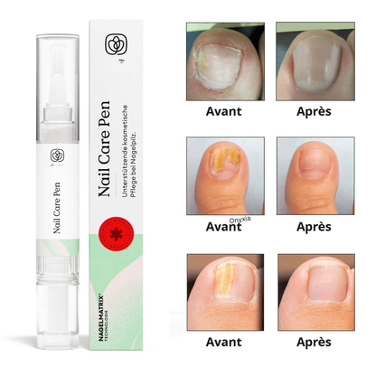 Onyxia™ — Pieds nus sans complexes.